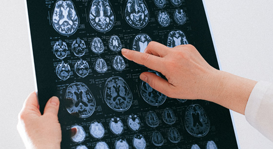 Photo of researcher looking at a brain scan - Pexels Anna Shvets Photographer