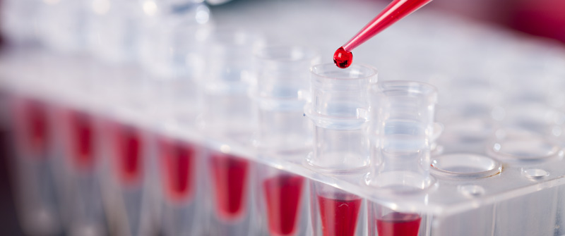 Photo of test tubes with red liquid being added in a laboratory setting.