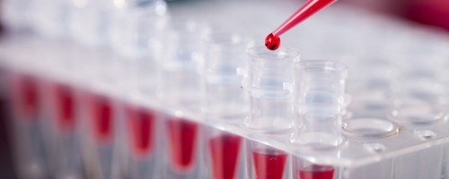 Photo of test tubes with red liquid being added in a laboratory setting.
